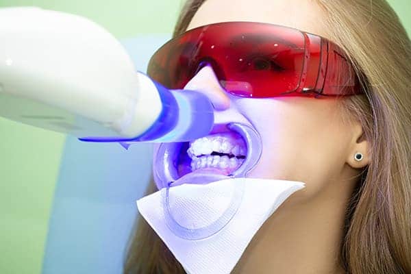 Laser teeth whitening treatments Bedford