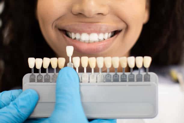 Laser Teeth Whitening: Exploring the Longevity of Your Brighter Smile Bedford