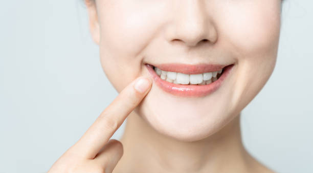 Comparing the Pain Factor: Laser Teeth Whitening vs. Zoom Teeth Whitening Bedford