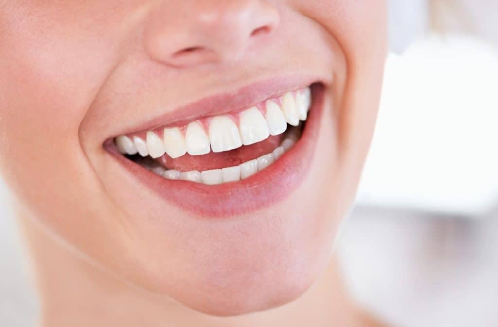 Teeth Whitening West Drayton Bedford