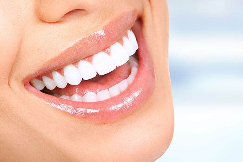 Teeth Whitening Abingdon Bedford