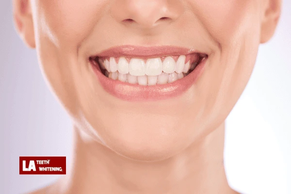 Is Laser Teeth Whitening Bedford Safe? Bedford